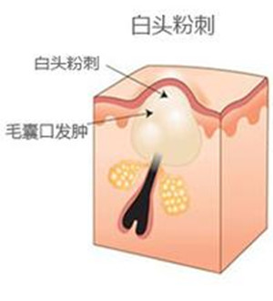 2-160629161P54T.jpg