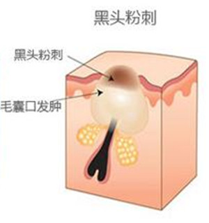 2-160629161S9A3.jpg