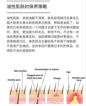 油性皮肤的保养策略